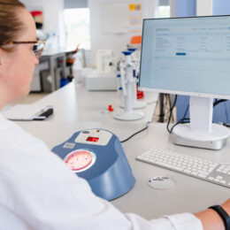 Register the count in the BiosistoChart and check whether the quality of the analyzes has been sufficient