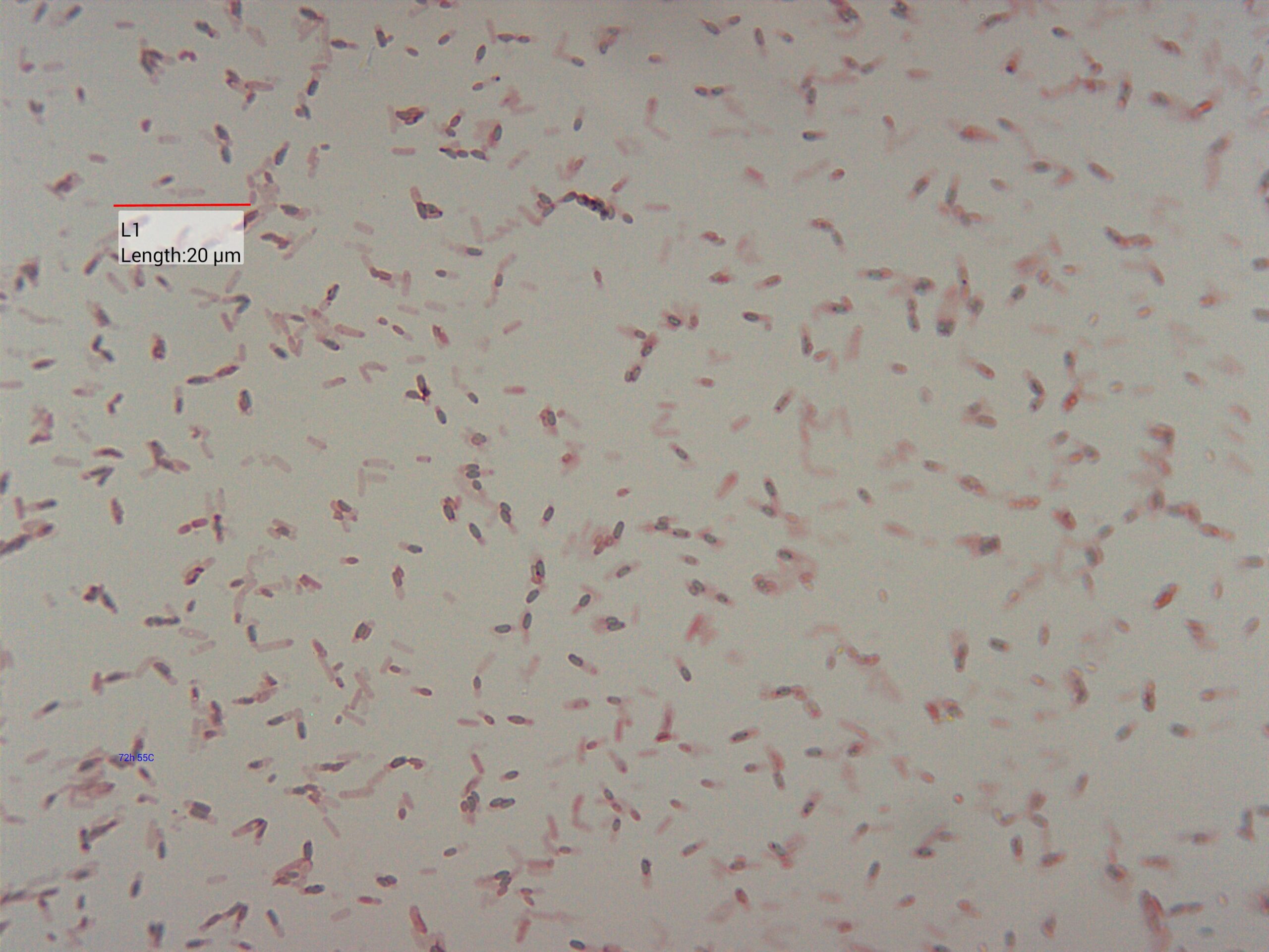 Geobacillus stearothermophilus cell and spore staining - microscopy ...