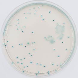 CRM-EC.O157 on RAPID'E.coli 2 Medium