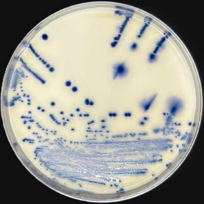 ESBL agar - Escherichia coli