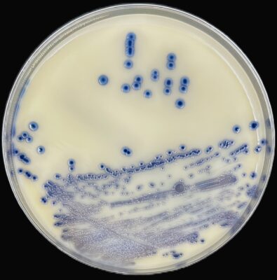 MRSA Chromagar - Staphylococcus aureus