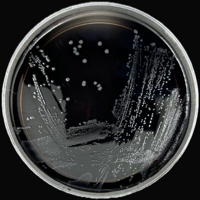 VRE Chromagar - Enterococcus faecalis